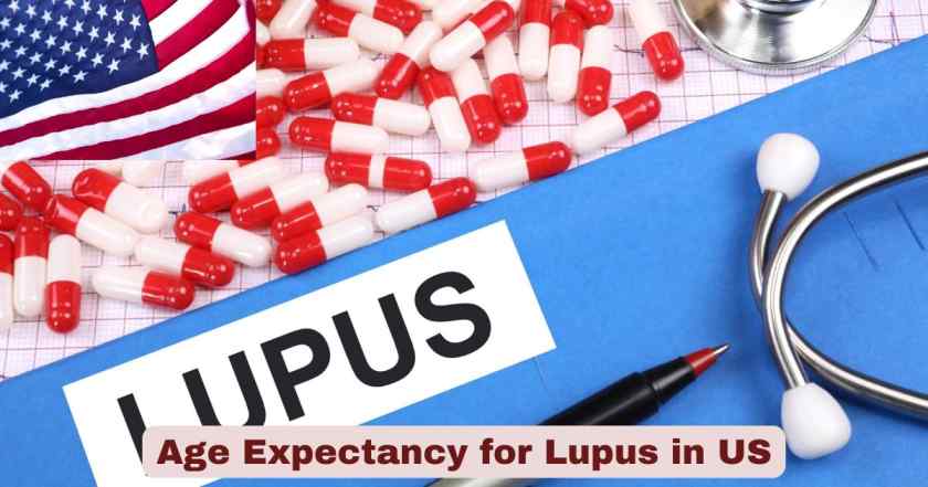 Age Expectancy for Lupus
