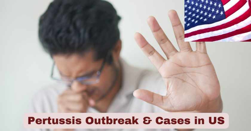 Pertussis Outbreak & Cases in US