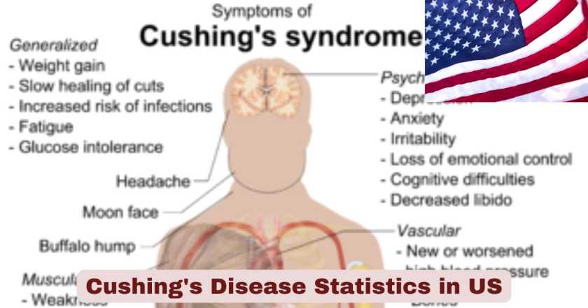 Cushing's Disease Statistics in US