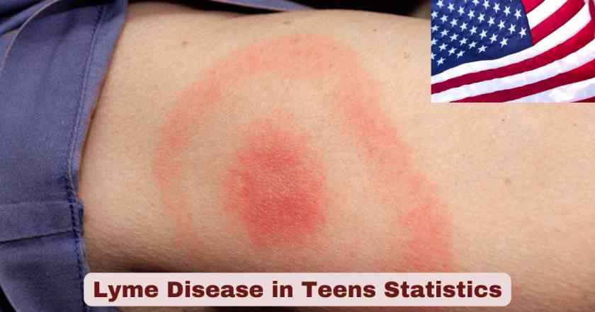 Lyme Disease in Teens