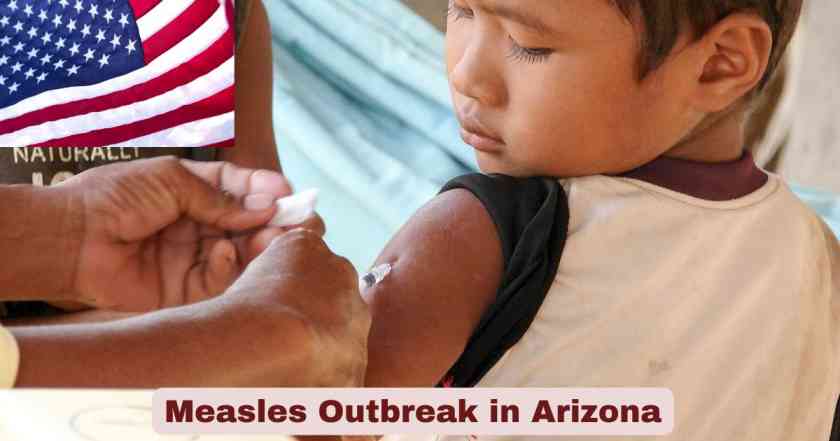 Measles Outbreak in Arizona
