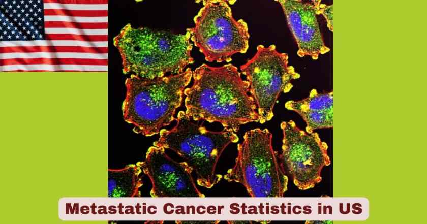 Metastatic Cancer in US