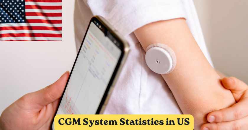 CGM System in US