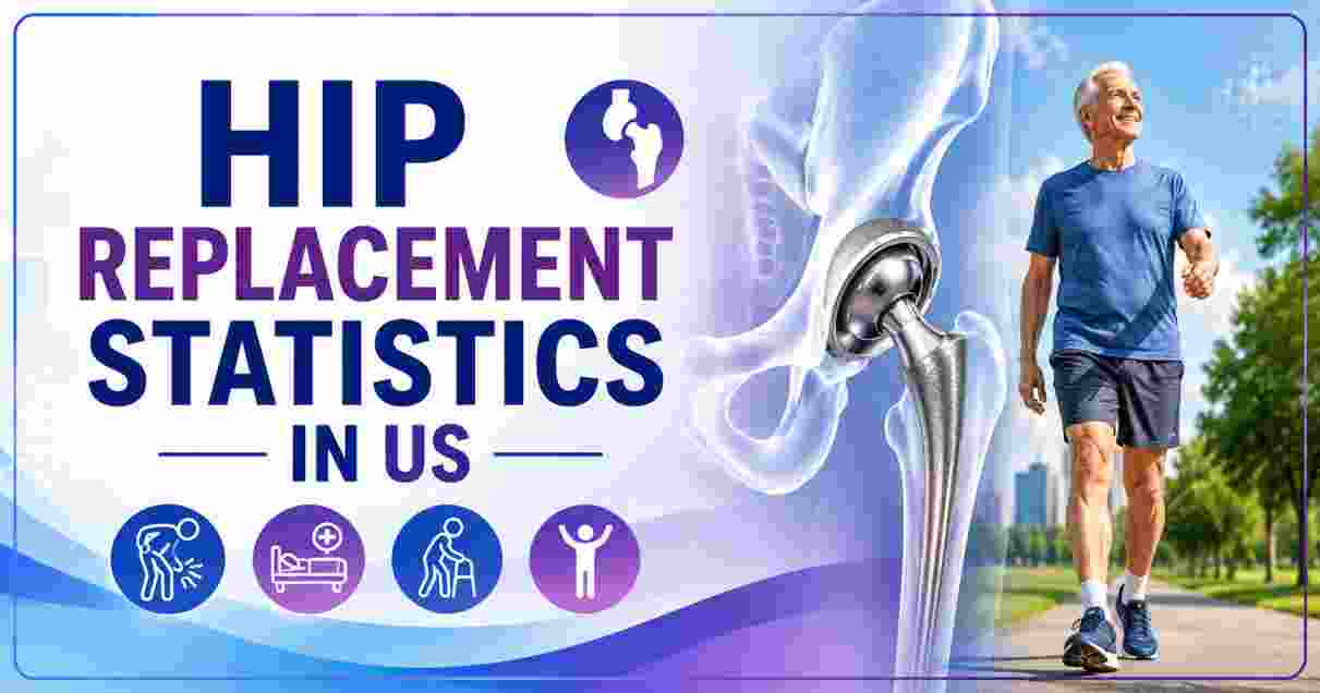 Hip Replacement Statistics in US