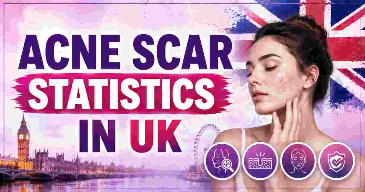 Acne Scar Statistics in UK