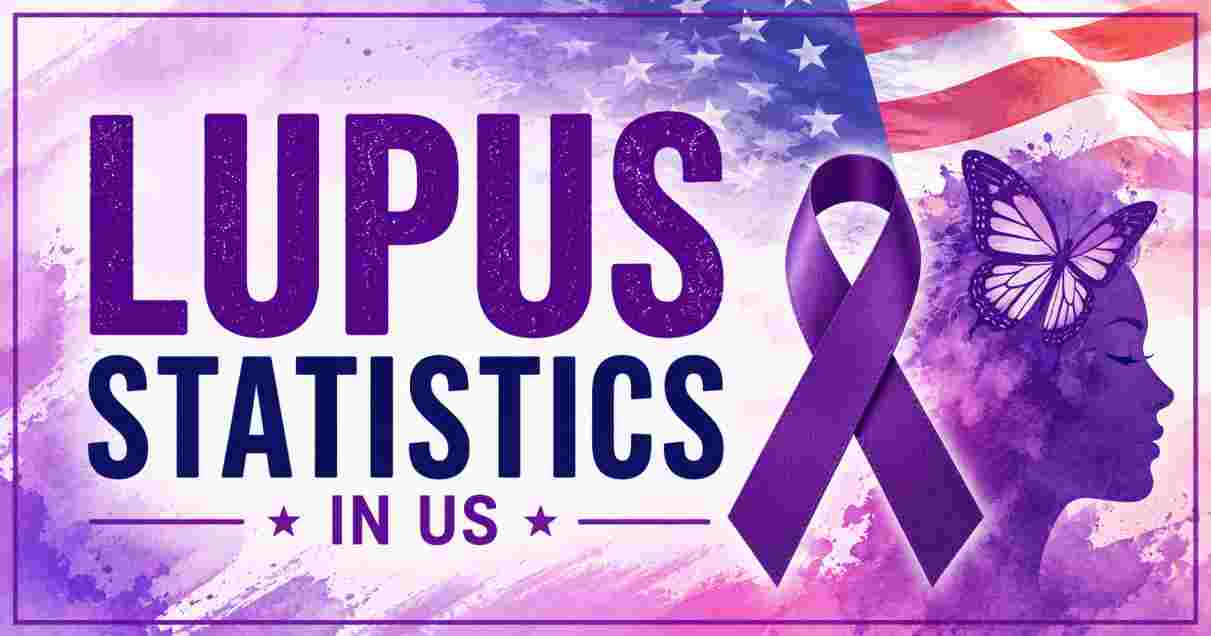 Lupus Statistics in US