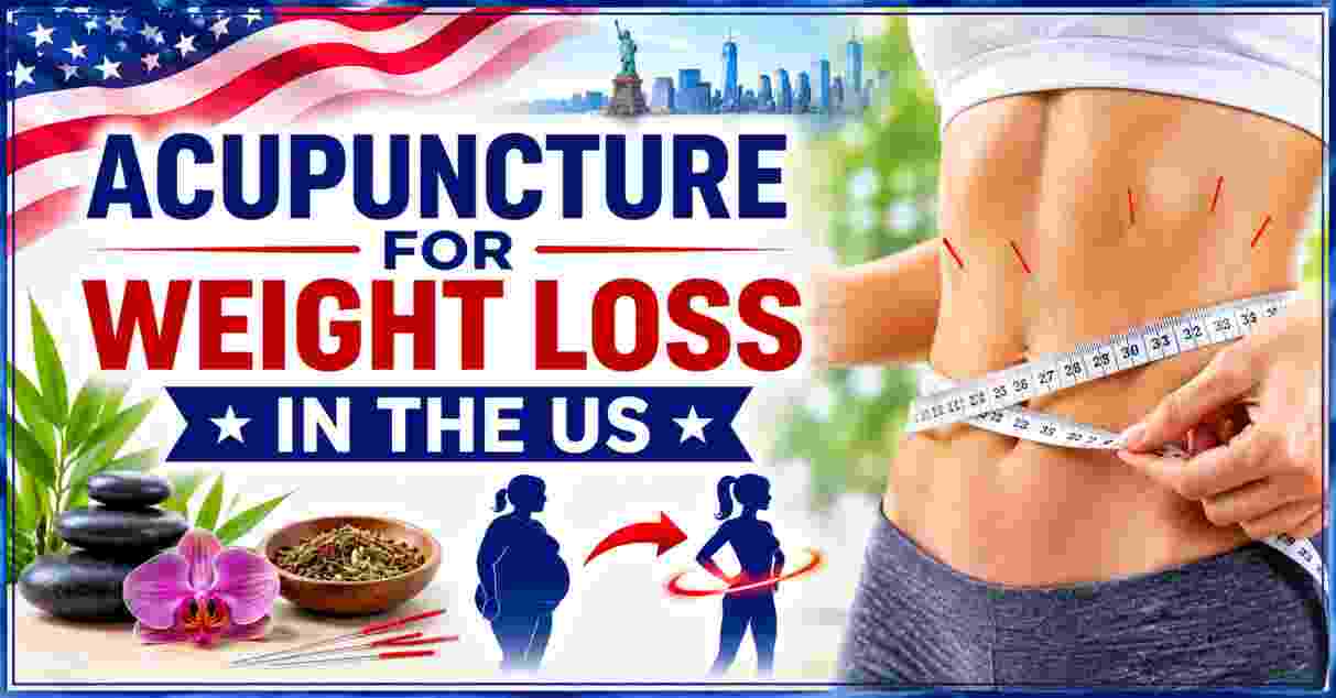 Acupuncture for Weight Loss in the US