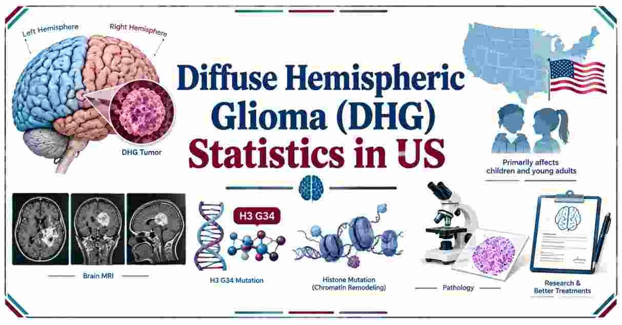Diffuse Hemispheric Glioma (DHG) Statistics in US