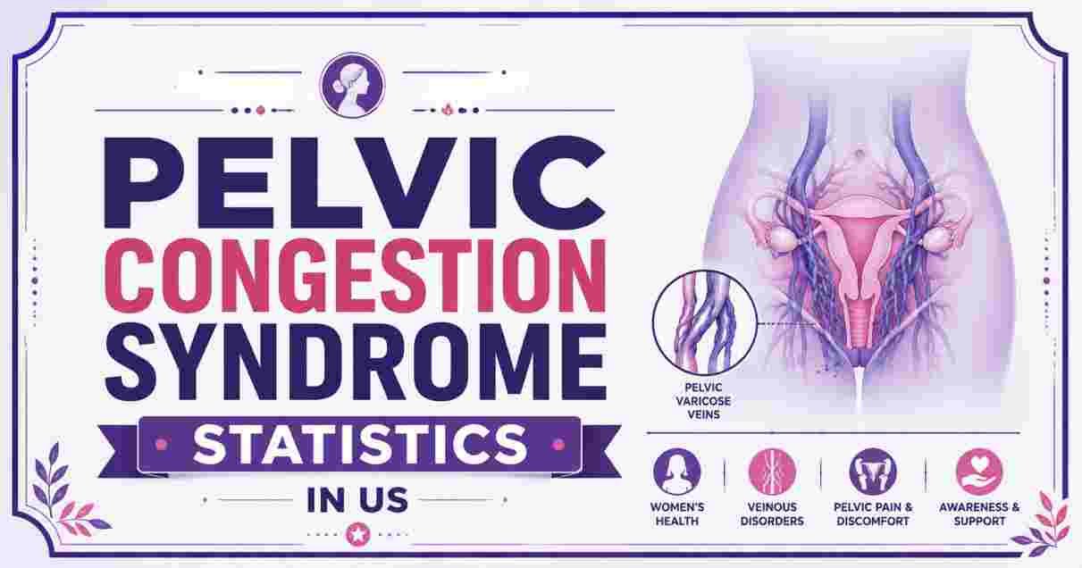 Pelvic Congestion Syndrome Statistics in US