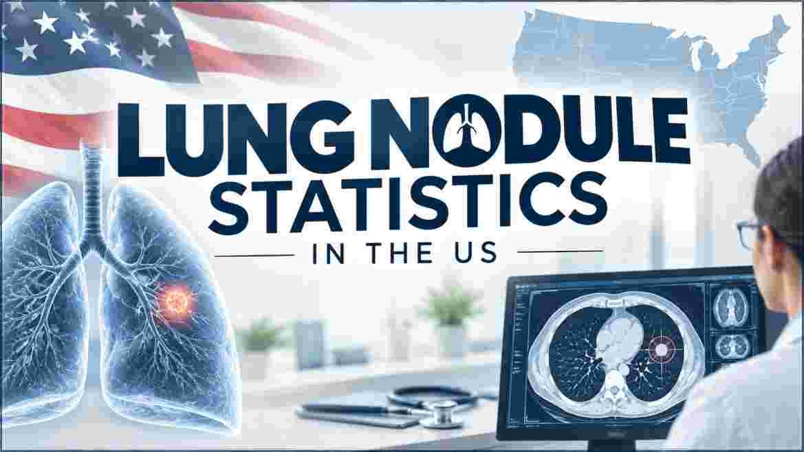 Lung Nodule Statistics in the US